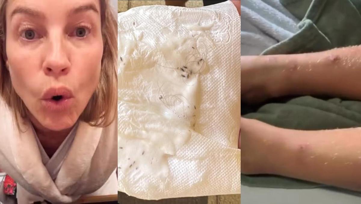 Luana Piovani expõe piolhos e ferimentos nos filhos e volta a cutucar Pedro Scooby